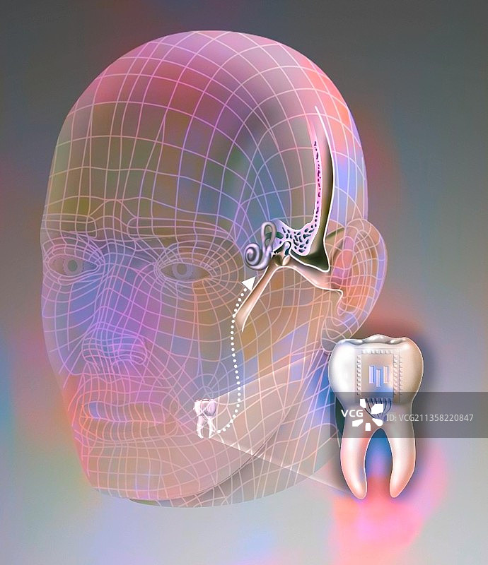 牙科电话原理：将声波从牙齿发送到内耳图片素材