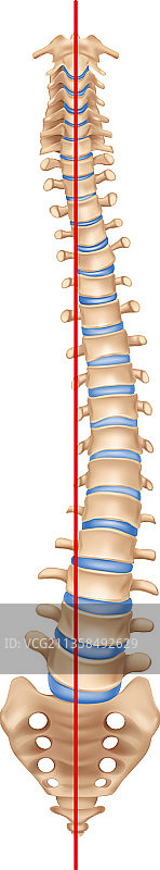 脊柱侧弯逼真效果图片素材