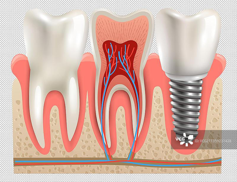 口腔健康牙齿修补图片素材