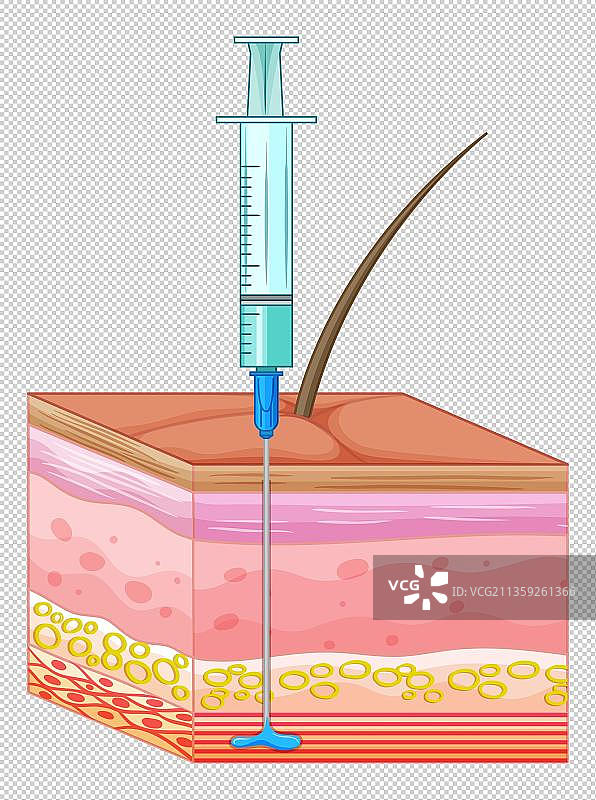 针管深入深层肌肤图片素材