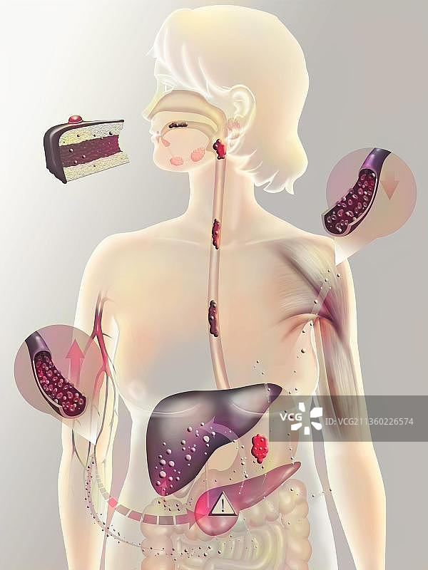 2型糖尿病患者的胰岛素分泌图片素材