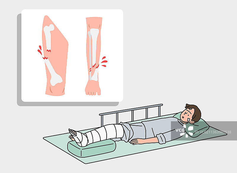腿部骨折卧床病人图片素材