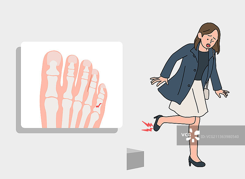 穿高跟鞋导致的脚趾骨折事故图片素材
