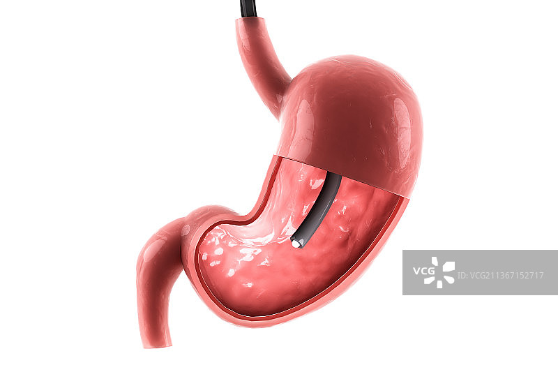 3D渲染的人体胃部结构图片素材