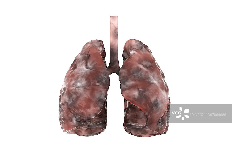 3D渲染的肺部结构图片素材