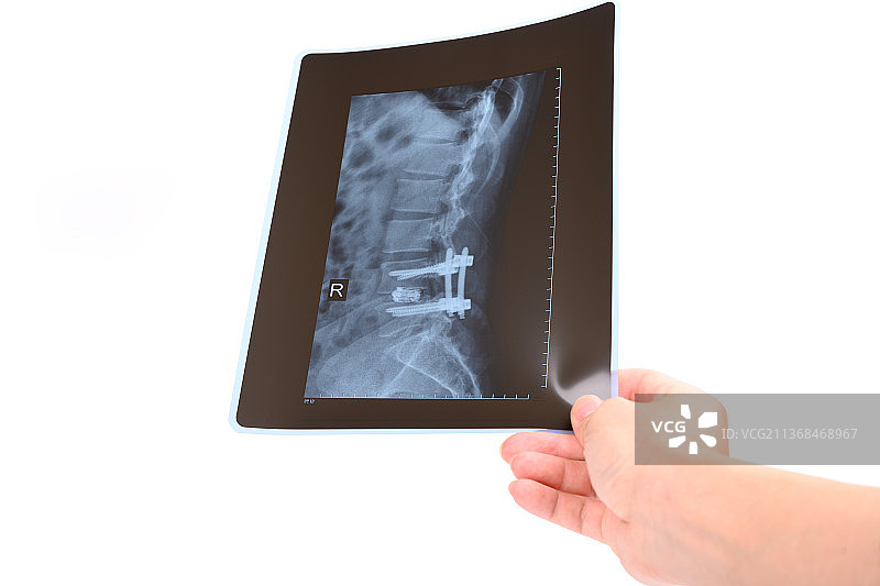 白色背景上一只手拿着X光片图片素材