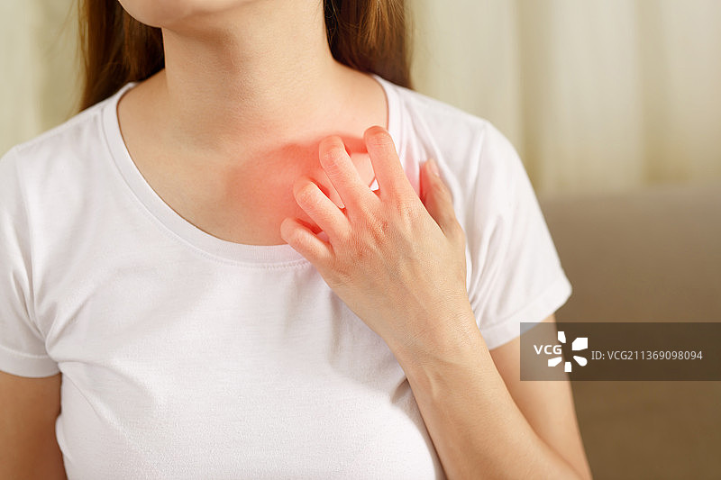 因新冠病毒感染而患有皮肤瘙痒、过敏的女人图片素材