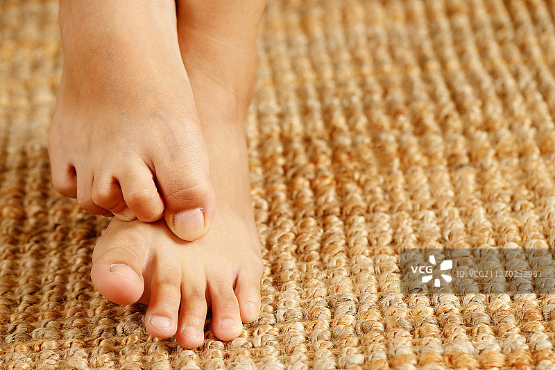 足癣引起的足部瘙痒图片素材