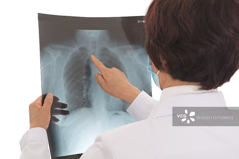 中国冠状新型肺炎期间女医生在认真的查看患者肺部X光片图片素材