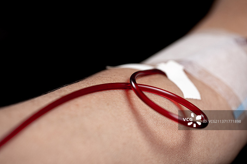 流动献血与血液透析图片素材