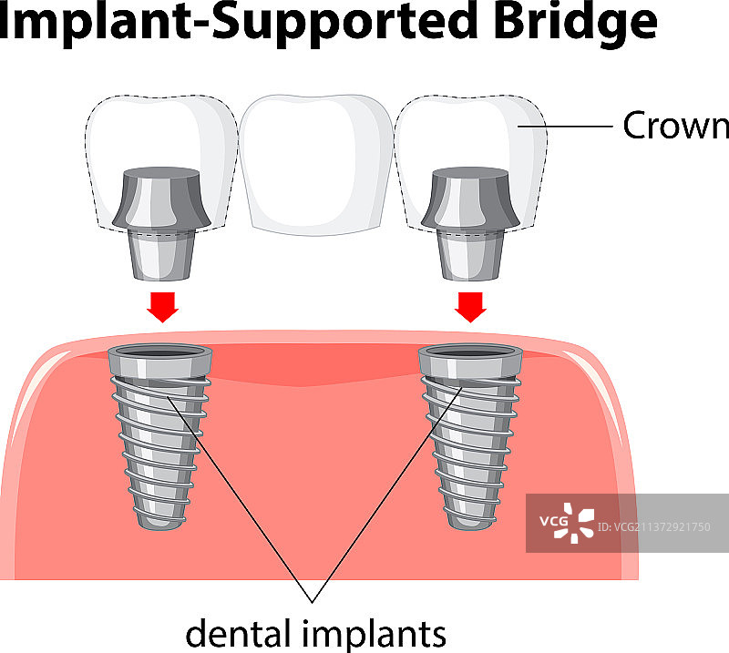 人体牙齿结构信息图图片素材