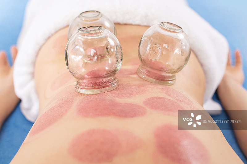 真空拔罐疗法背景美容产品图片素材