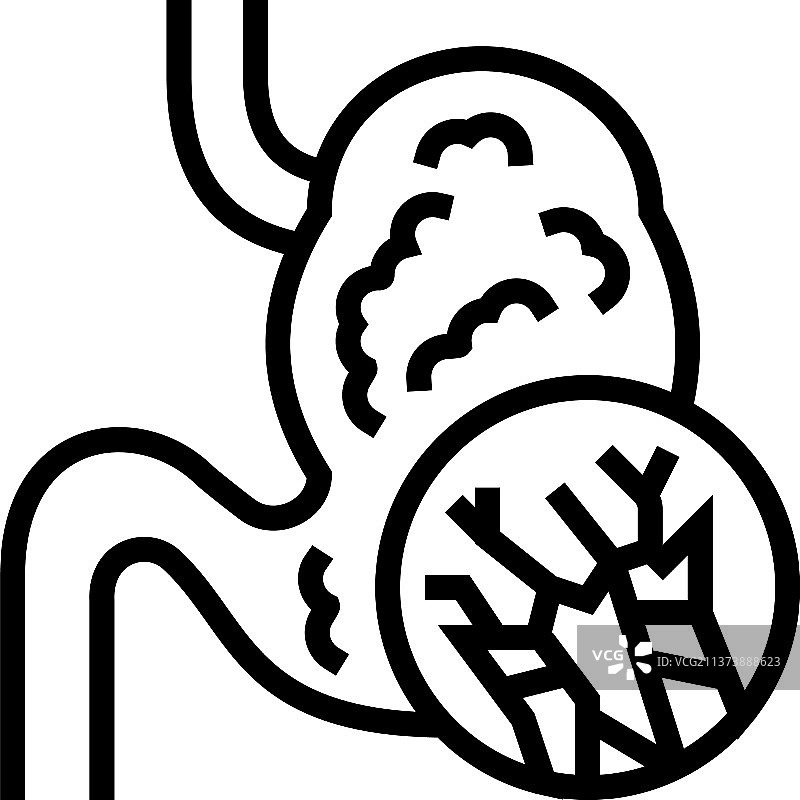 腹部肿胀间皮瘤线性图标图片素材