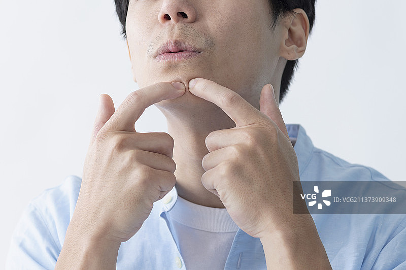 商业男性正在用手挤压青春痘图片素材