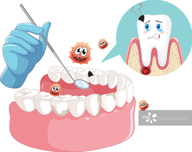 牙医手持人类龋齿模型图片素材