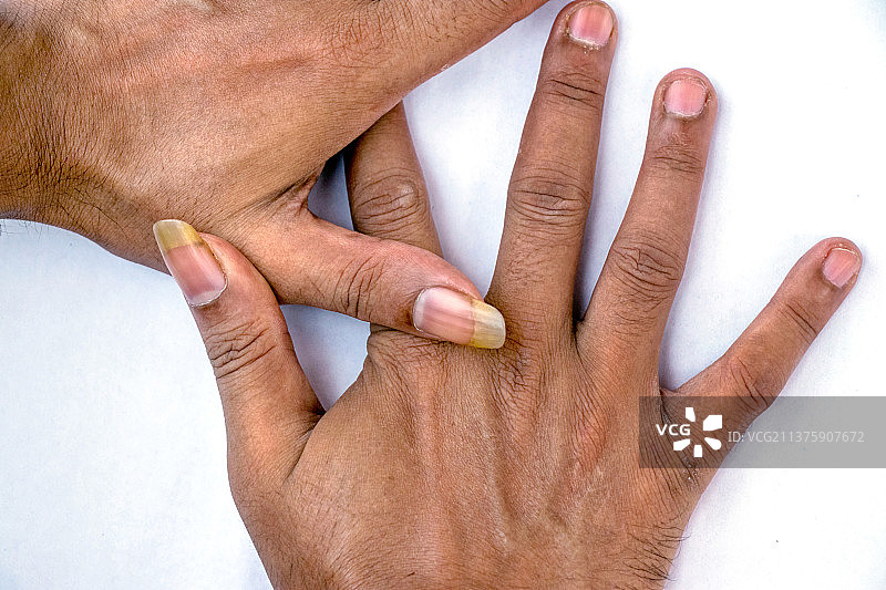 白色背景上，指甲又大又脏的手图片素材