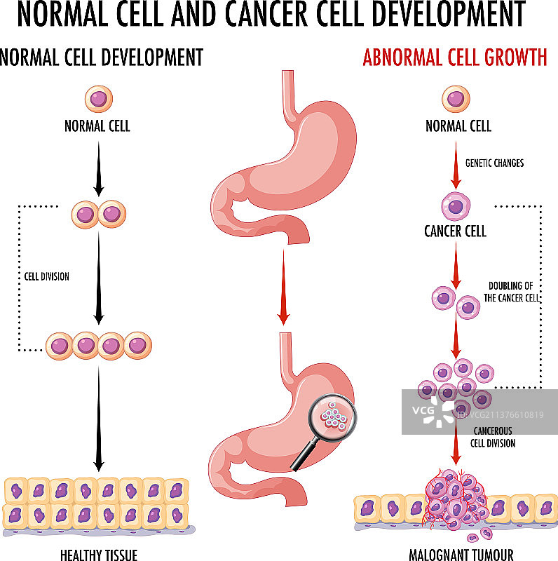 人体正常细胞和癌细胞示意图图片素材