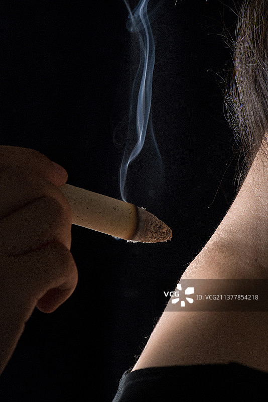 女性艾灸特写图片素材