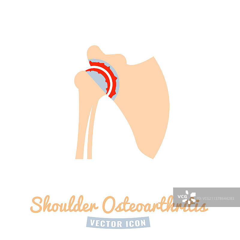 肩关节骨关节炎图标图片素材