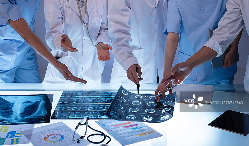 医务工作者用手指着X光片讨论研究图片素材