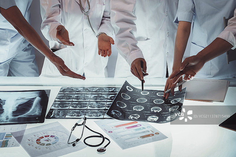 医务工作者用手指着X光片讨论研究图片素材