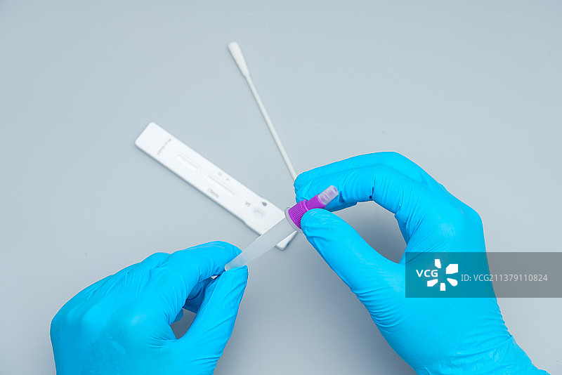 带着蓝色手套的手拿检测试剂瓶图片素材