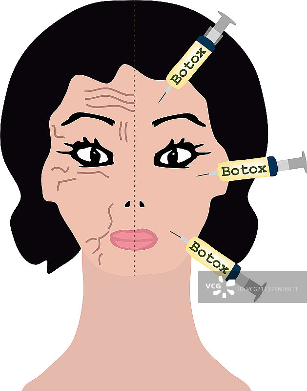 半张脸上的皱纹肉毒杆菌治疗图片素材