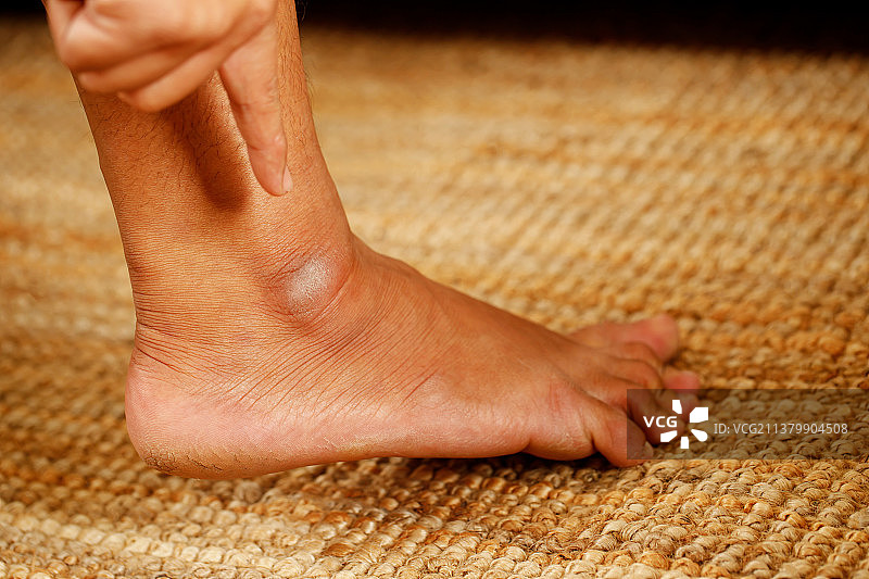 皲裂脚后跟护理足霜图片素材