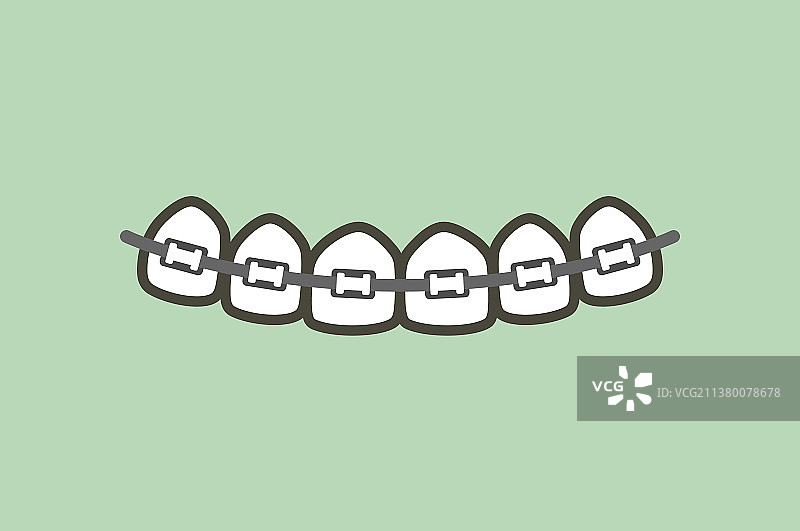 正畸牙齿或牙套图片素材