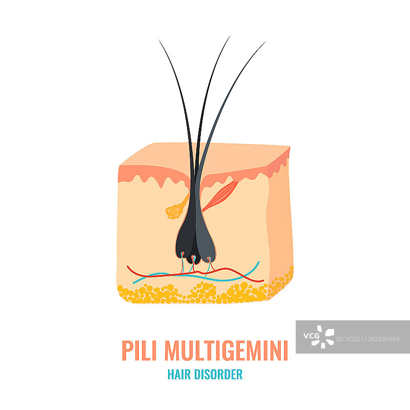 多发性毛发病特写图片素材