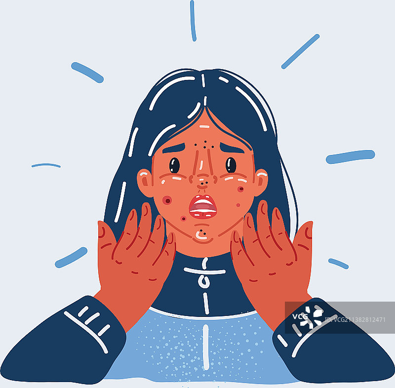 有痤疮的少女图片素材