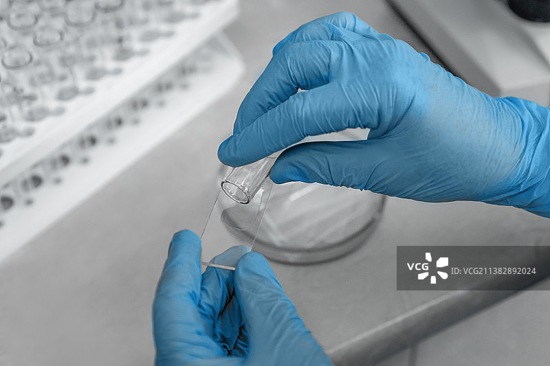 医疗设备：戴防护手套的手拿着药物测试图片素材