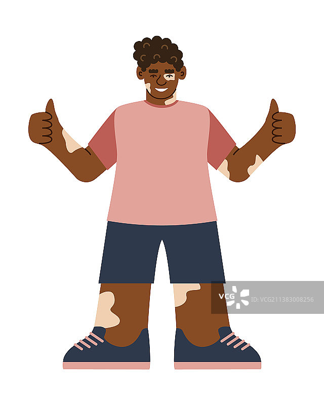 患有白癜风的微笑的年轻非洲男人少年图片素材