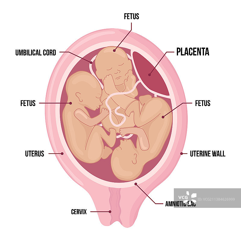 子宫内的三胞胎胎儿图片素材