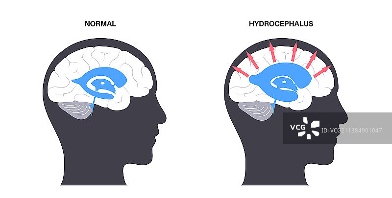 心室系统概念图片素材