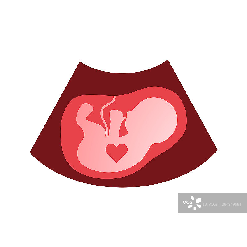 胎儿的红色超声波图片图片素材