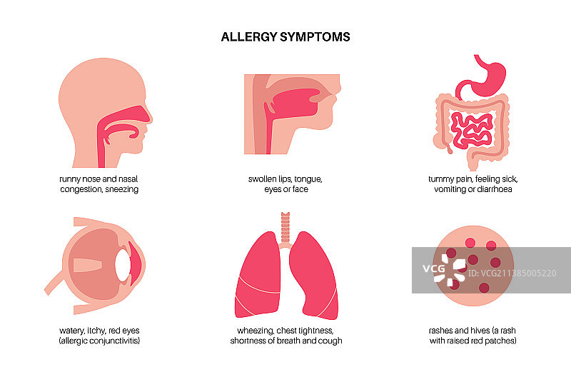过敏症状概念图片素材