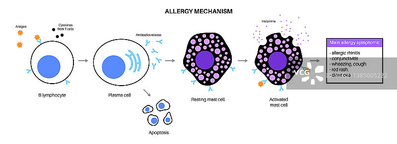 过敏机制图解图片素材