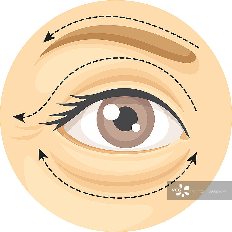 眼睑整形术美容外科手术图片素材