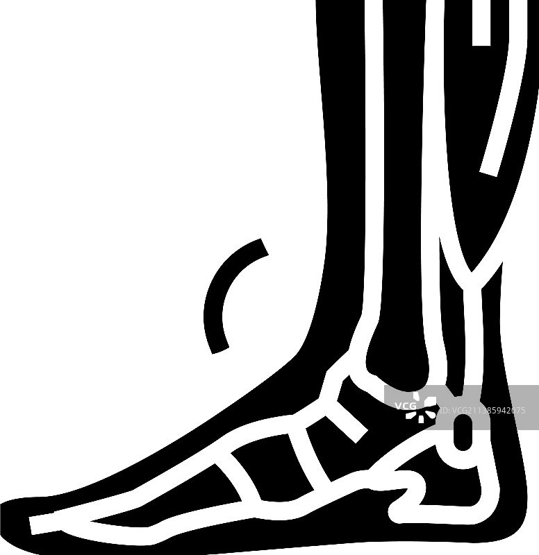 肌腱炎问题标志图标图片素材