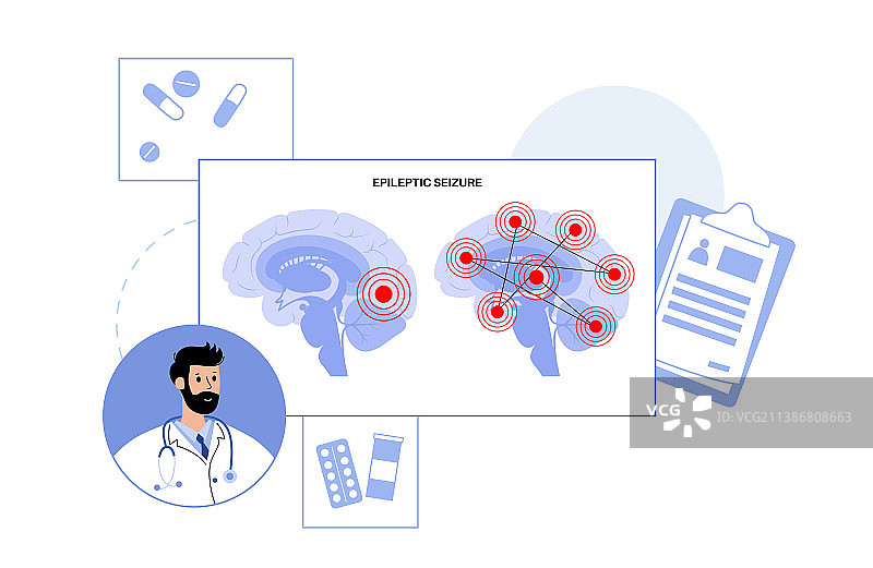 癫痫发作概念图片素材