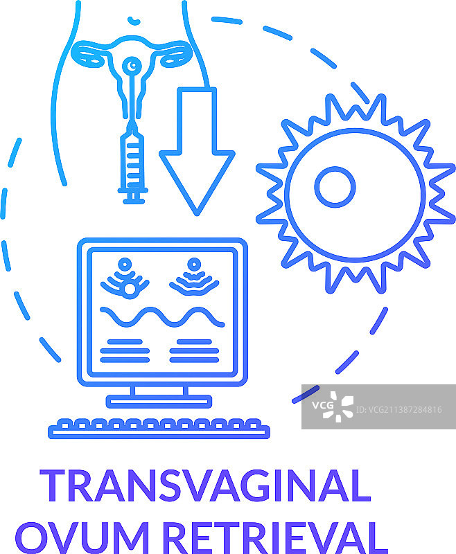 蓝色经阴道取卵概念图标图片素材