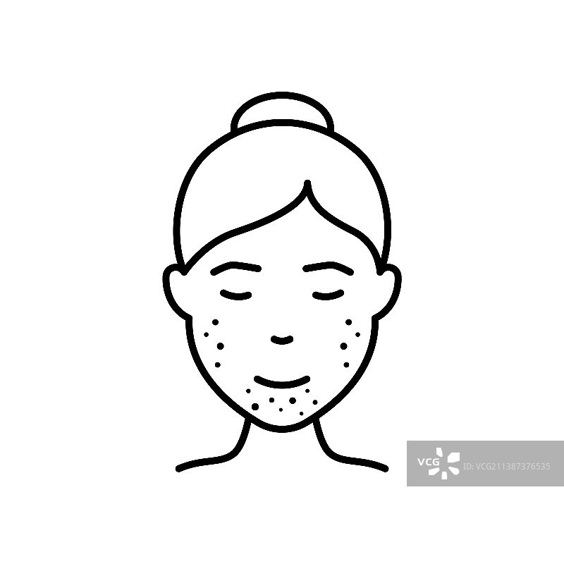 脸部黑头粉刺皮疹的女人线条图标图片素材
