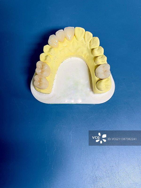 全瓷冠假牙图片素材