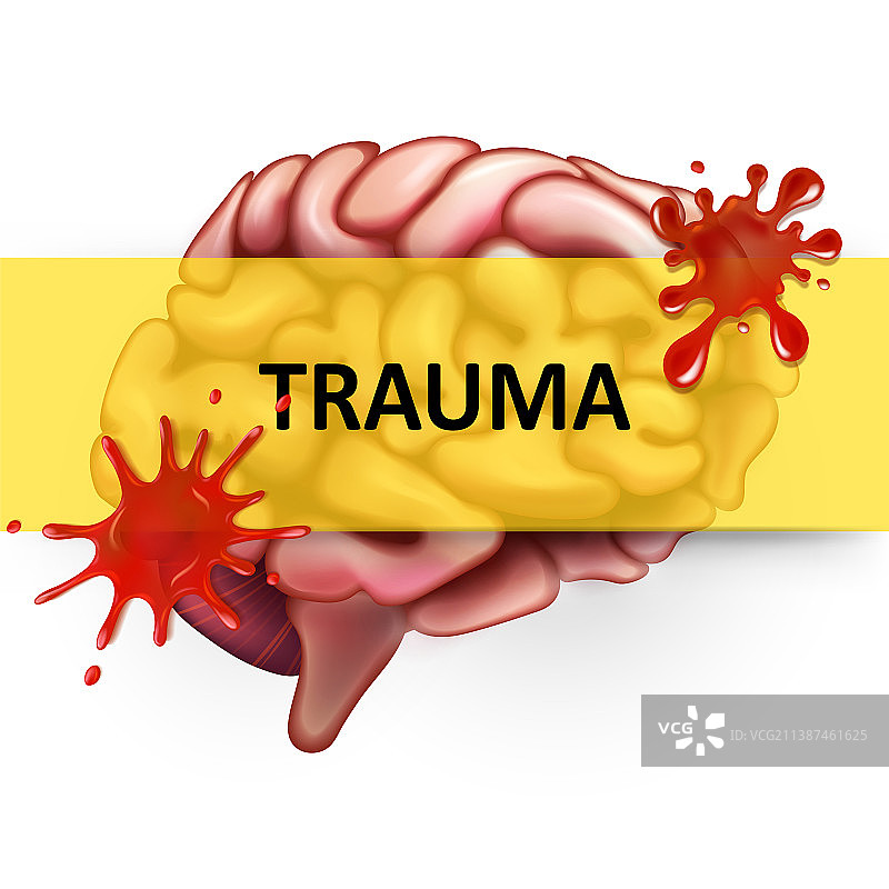 脑部疾病与创伤图片素材