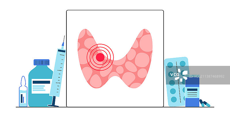 甲状腺机能减退，甲状腺图片素材