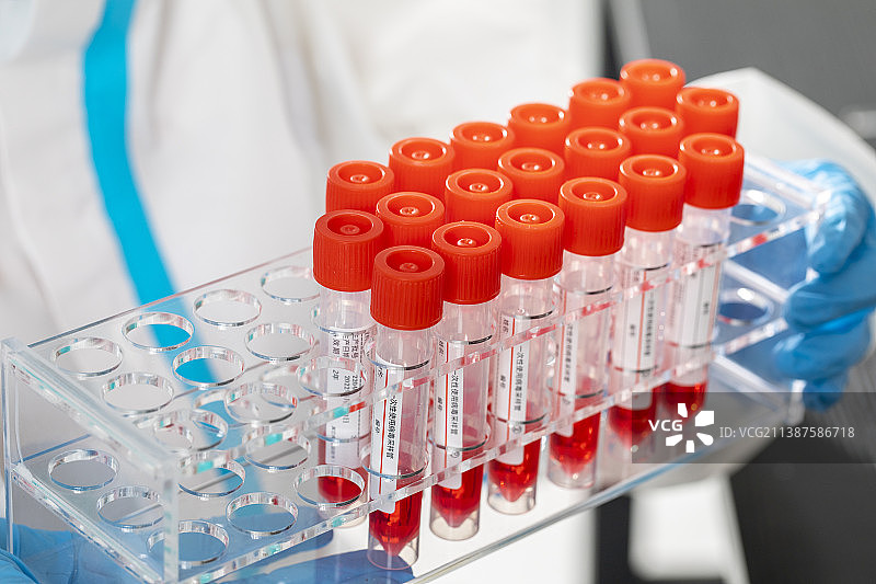 实验室里的检测试剂图片素材