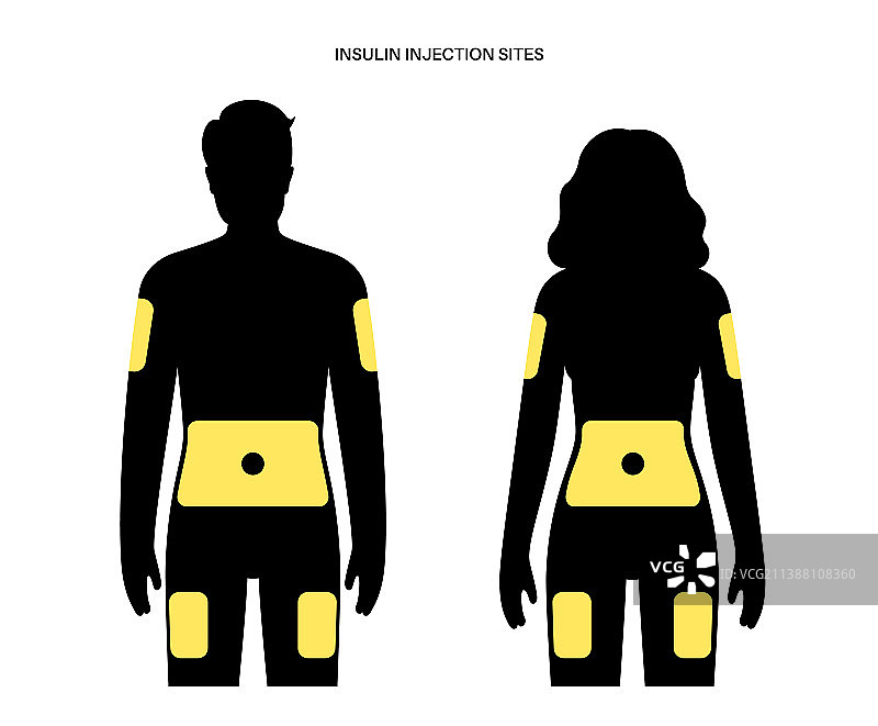 胰岛素注射部位图片素材