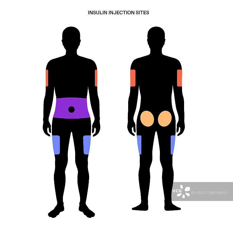 胰岛素注射部位图片素材