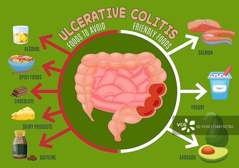 溃疡性结肠炎肠道疾病饮食图片素材